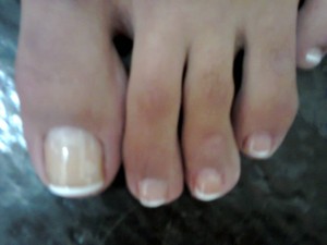 Медицински педикюр- домашни посещения.