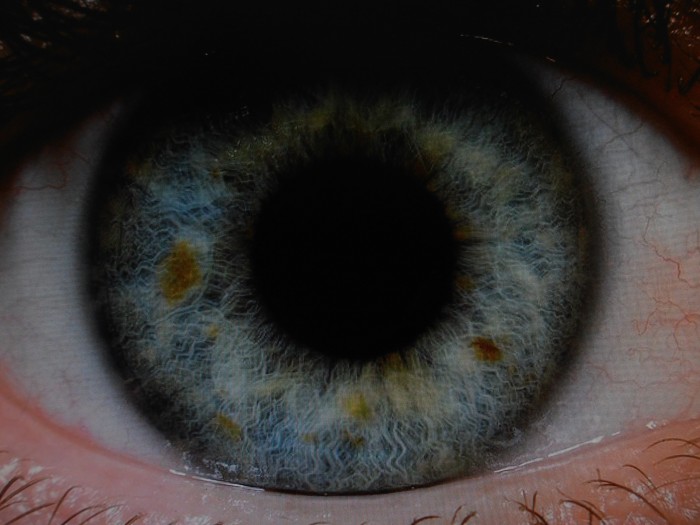 очно протезиране  "Окуспейс" София