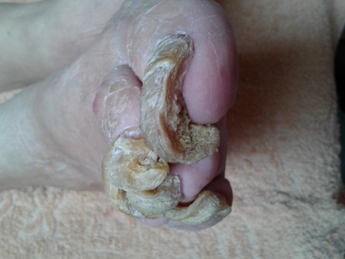 Медицински педикюр от квалифициран специалист с опит по домовете.